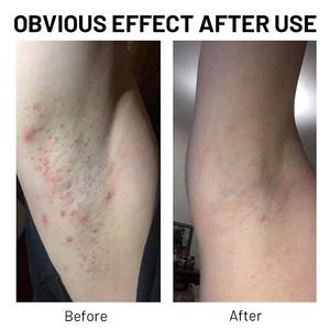 Huile Essentielle Pure à Ingrédients Naturels Marque Blanche Anti-Démangeaisons Hydratante Lissante pour Peau, Contre les Boutons de Rasoir et les Poils Incarnés - Product Image 6