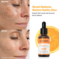 NEUTRIHERBS Marque de cosmétiques française en marque privée Derma Roller Sérum anti-âge à la vitamine C
