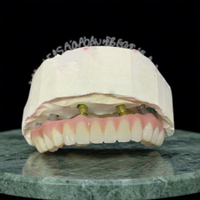 Prothèse dentaire implantée avec piliers en titane et couronne en zircone, fabrication sur mesure CAD/CAM pour cliniques et laboratoires dentaires