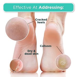 Masque Peeling <span class=keywords><strong>Pied</strong></span> Avancé De Marque Privée En Gros Japonais Aider À Renouveler La Peau Masque Anti-Fissuration Du Talon - Product Image 3