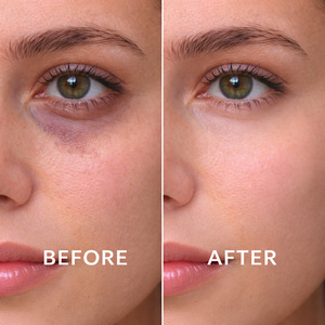 Crema Iluminadora para Ojos - Esencia para Ojos con Ceramida y Cafeína con Bola Metálica Refrescante - Paquete de Viaje 15ml - Product Image 2