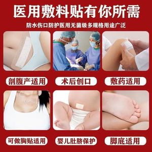 Pansements stériles, pansements médicaux de grande taille, ruban adhésif respirant, pansements pour plaies, pansements pour cordon ombilical - Product Image 2