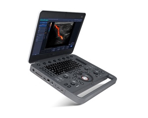 Equipo de Ultrasonido Doppler Color Portátil de Alta Gama Sonoscape X3V con Monitor LCD a Color de Alta Resolución de 15.6 Pulgadas - Product Image 1