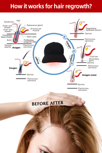 Casque de luminothérapie rouge infrarouge 660nm 850nm 940nm 5 longueurs d'onde pour soulagement des maux de tête, biomodulation sans fil - Product Image 4