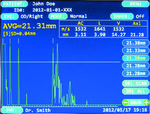 Paquímetro oftálmico SPA-100 A-Scan con función de reconocimiento macular, mide con precisión Axial - Product Image 5