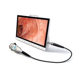 Sistema de Cámara de Endoscopia Portátil de 13.3 Pulgadas y 1080P con Grabador para Laparoscopia ENT TU-13.3DB, Cámara de Endoscopia Médica TU-13.3DB - Product Image 5
