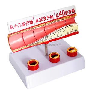 Медицинские науки, возрастные сосудистые изменения ишемической болезни сердца, тромбоз, Липиды и холестерин в крови человека - Product Image 1