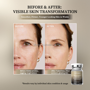 Suero <span class=keywords><strong>de</strong></span> Péptidos <span class=keywords><strong>de</strong></span> <span class=keywords><strong>Veneno</strong></span> <span class=keywords><strong>de</strong></span> <span class=keywords><strong>Serpiente</strong></span> Multipéptidos, Suero Antienvejecimiento y Antiarrugas, Kit <span class=keywords><strong>de</strong></span> Suero Facial para Eliminar Arrugas - Product Image 4