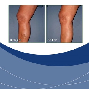 แผ่นแปะสมุนไพรพรีเมียม บรรเทาอาการปวดเมื่อย ช่วยกระตุ้นการไหลเวียนโลหิต เพื่อความสบายและสุขภาพที่ดีในทุกวัน - Product Image 2