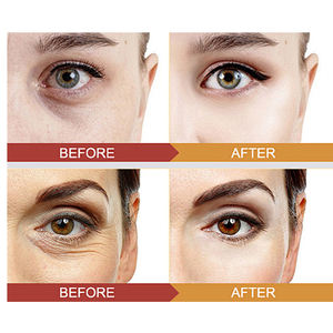 Crema de <span class=keywords><strong>Ojos</strong></span> con Bola Masajeadora, Hidratante, Reafirmante, Reduce Líneas Finas, Esencia para <span class=keywords><strong>Ojos</strong></span> - Product Image 3