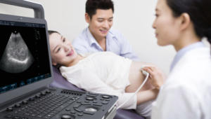 MSLCU77 컬러 도플러 초음파는 소노스케이프 E3 초음파 스캐너와 유사합니다. - Product Image 3