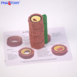 Modelo Anatómico Vascular de Cuatro Etapas para el Estudio de la <span class=keywords><strong>Enfermedad</strong></span> de <span class=keywords><strong>Arteriosclerosis</strong></span> Humana, Modelo de Vaso Arterial Humano, Regalo Educativo - Product Image 4