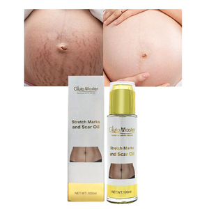 热销妊娠纹去油紧致滋养孕期孕妇腿部大腿妊娠纹女用油 - Product Image 1