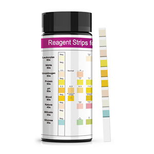 Bandelettes de test <span class=keywords><strong>urinaire</strong></span> en gros à 9 paramètres : <span class=keywords><strong>Glucose</strong></span>, Cétones, Bilirubine, Leucocytes, Nitrites, Protéines - Product Image 6