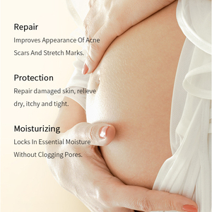 <span class=keywords><strong>Aceite</strong></span> DE PREVENCIÓN DE ESTRÍAS Natural orgánico vegano cuidado de la piel regenerar reparación de <span class=keywords><strong>cicatrices</strong></span> <span class=keywords><strong>aceite</strong></span> corporal para estrías - Product Image 3