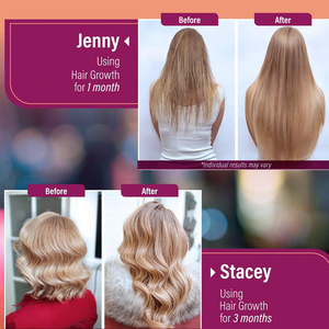 Synkonda OEM Complément Alimentaire pour la Croissance des Cheveux, Capsules de Collagène et Vitamines, Feuilles d'Aloe <span class=keywords><strong>Vera</strong></span>, Riches en Protéines, Sans Gluten, 120 Comprimés, Arrête la Chute des Cheveux - Product Image 5