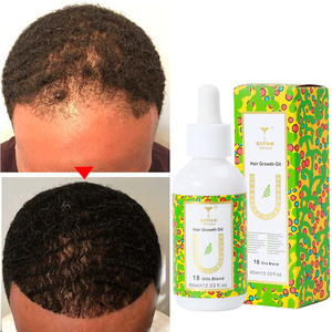 3000 100ml <b>Fast</b> <b>Hair</b> <b>Growth</b> <b>Oil</b> Repair <b>Hair</b> Scalp Care Anti <b>Hair</b> Loss Treatment Herbal Regrowth Thicken Serum Essence Liquid - Product Image 3