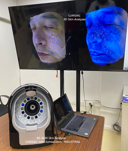 Dispositivo <span class=keywords><strong>de</strong></span> análisis cutáneo para cadenas minoristas - Product Image 3