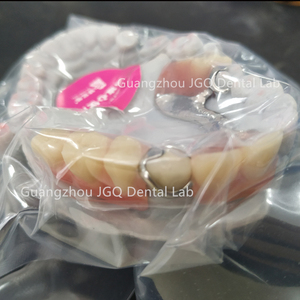 Prothèses fixes amovibles avec dents en métal en acrylique Externalisation de laboratoire dentaire Services complets - Product Image 4
