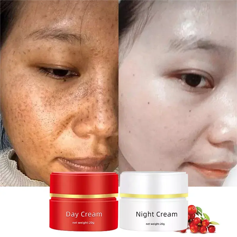 OEM Melasma Pimples Blemish Removal Strong Bleaching Whitening Face Freckles Remove Dark Spot Remover Corrector Cream