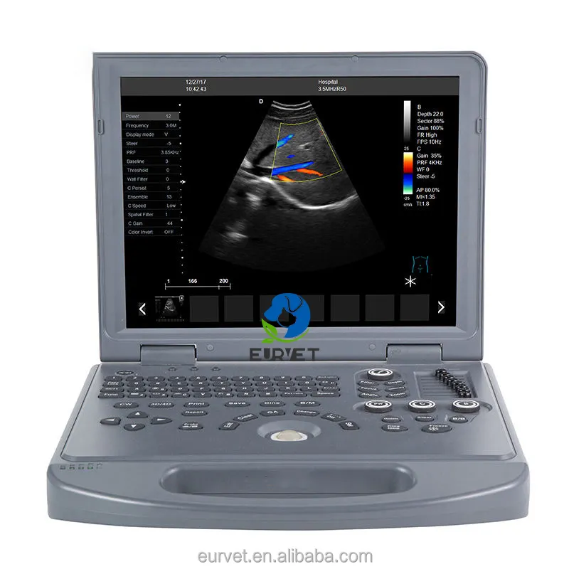 EUR PET Best Price Doppler Ultrasound Machine Hand-carried Portable 3d 4d Color Ultrasound Doppler For Hospital