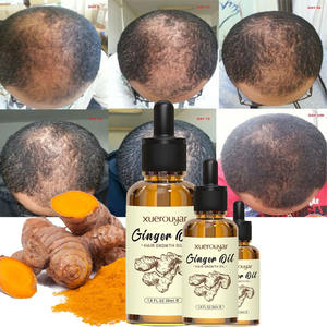 Ingrédient OEM ODM traitement des cheveux sérum de massage de la tête du cuir chevelu huiles essentielles réparation nourrissante prévenir la perte de cheveux huile de croissance au gingembre - Product Image 1