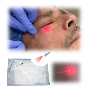 <span class=keywords><strong>Precio</strong></span> de fábrica Eliminación de grasa 980nm Diodo <span class=keywords><strong>Láser</strong></span> Lipólisis Liposucción Vaser Liposucción Endolaser Lift Machine - Product Image 4