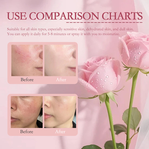 <span class=keywords><strong>Eau</strong></span> <span class=keywords><strong>de</strong></span> <span class=keywords><strong>rose</strong></span> pure et naturelle 100% naturelle, hydrolat éclaircissant, anti-âge, hydratant, beauté visage et cou, tous types <span class=keywords><strong>de</strong></span> peau - Product Image 5