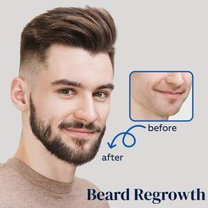 Aceite para Barba Puro y Natural con Romero y Vitamina E - Nutritivo y Fortalecedor, Sin Perfume, Fijación Fuerte, 30ml, OEM Personalizado - Product Image 4