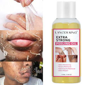 Aceite Exfoliante Extra Fuerte, Eliminador de Manchas Oscuras, Eliminación de Piel Muerta, Aclara el Tono de la Piel - Product Image 2
