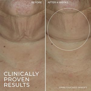 Stick Siero Rassodante al Retinolo Personalizzabile, Antirughe, Antiossidante, ad Assorbimento Rapido, Crema Contorno Occhi al Retinolo in Confezione per Tutti i Tipi di Pelle - Product Image 5