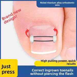 Dispositif de correction des ongles incarnés en alliage de nickel-titane avec patch <span class=keywords><strong>pour</strong></span> ongles - Product Image 3