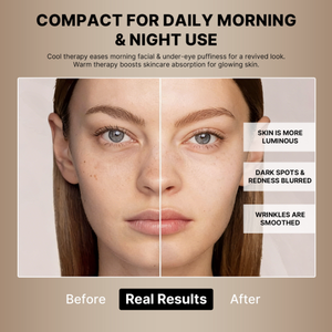 <span class=keywords><strong>Prix</strong></span> de gros Appareil de beauté 4 en 1 chaud et froid Appareil facial galvanique professionnel chaud et froid - Product Image 4