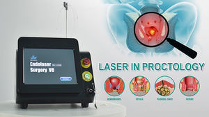 Máquina de Tratamento de Hemorroidas e Fístula Anal a Laser Diode Portátil de Alta Potência 30W+17W 980nm1470nm Mais Recente de 2026 - Product Image 4