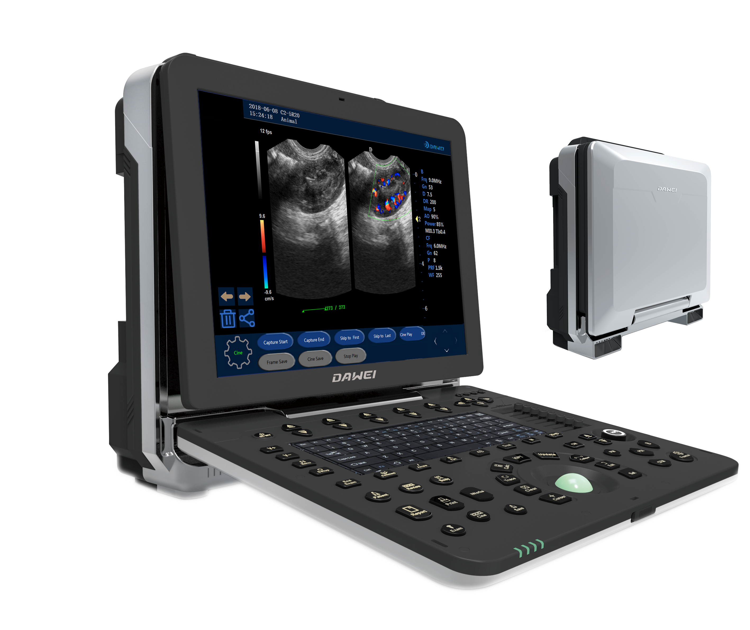 dw- vet11 便携式 4d彩色多普勒兽用超声诊断仪系统