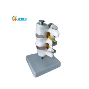 Model herniasi Lumbar manusia kolom tulang belakang vertebra dapat dilepas untuk chiropractor 3 Model vertebra - Product Image 1
