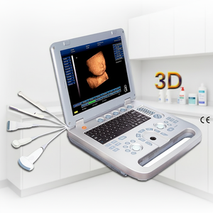 Nouvel appareil d'échographie portable 2026 – Scanner médical à ultrasons de type ordinateur portable - Product Image 1