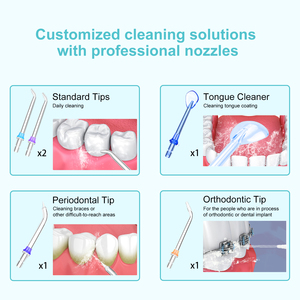 Có thể sạc lại không dây nước Flosser IPX7 300ml Irrigator Miệng răng Làm sạch USB/Battery Powered 15 năm chăm sóc răng miệng nhà máy - Product Image 6