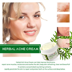 <span class=keywords><strong>Crema</strong></span> para el Acné con Aceite de Árbol de Té OEM, Fórmula Vegana Orgánica con Glicerina para Todo Tipo de Piel - Hidratante y Elimina Cicatrices - Product Image 5