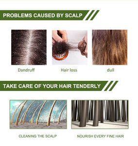 <span class=keywords><strong>Champú</strong></span> orgánico <span class=keywords><strong>antipiojos</strong></span> de alta calidad, conjunto de acondicionador y <span class=keywords><strong>champú</strong></span> nutritivo antipicazón para el cabello, Alisador, venta al por mayor - Product Image 4