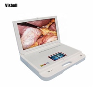 Caméra endoscopique portable équipement d'imagerie médicale caméra endoscopique HD pour ORL/laparoscopie/hystéroscopie/urologie
