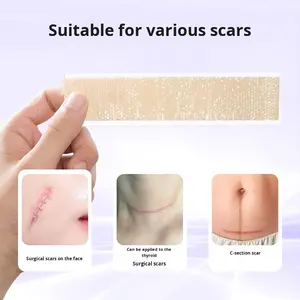 Patch de réparation des cicatrices médicales, gel de silicone pour césarienne, post-chirurgie thyroïdienne, cicatrices légères, chirurgie de double paupière, hyperplasie, plaie - Product Image 1