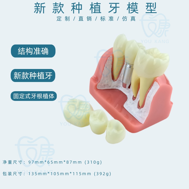 Un implante dental con fondo blanco y uña blanca.