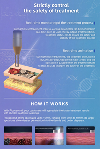 Máquina Láser de Picosegundos Nd YAG OEM 2026 Q-Switched 1064nm/755nm/532nm/650nm para Eliminación de Tatuajes y Equipos de Belleza - Product Image 5
