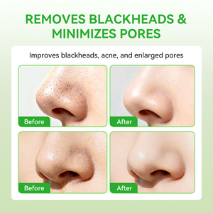 LANBENA Bandelettes Nettoyantes Points Noirs Minimisant les Pores, Patchs Purifiants Profonds pour le Nez à l'Aloe Vera pour Usage Quotidien, Prêts à l'Expédition - Product Image 3