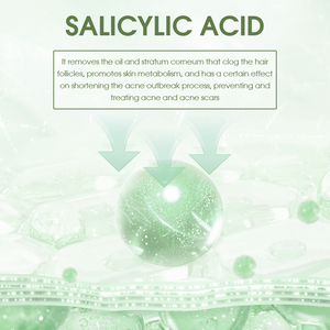 Sérum anti-acné WANXI à l'acide salicylique, hydratant, réparateur, régulateur de sébum, resserre les pores, éclaircissant, soin du <span class=keywords><strong>visage</strong></span> et du corps, tous types de peau, 30 ml - Product Image 4
