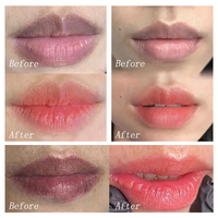 Crème hydratante blanchissante pour les lèvres, restauration de la couleur rose pour les lèvres foncées, marque privée, crème intime rose pour femmes
