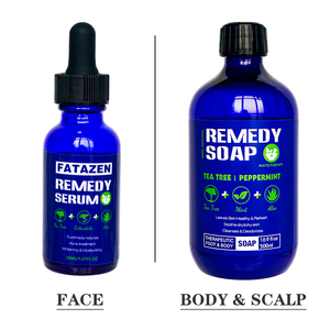 Private Label Natural Organic Remedy Serum trattamento per l'acne siero viso per la cura della pelle per siero Anti-età alla vitamina C al tè verde - Product Image 6
