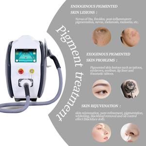 Macchina Laser per Rimozione Tatuaggi Nd Yag Q-Switched al Neodimio del 2023 - Product Image 3