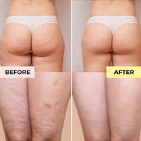 Marque privée Huile corporelle de massage 100% naturelle au collagène biologique pur Stemcell Huile de massage anti-cellulite pour SPA